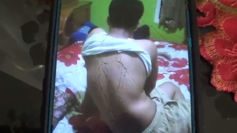 title Pelajar SMAN 3 Sumbar Diduga Dibully Teman di Asrama hingga Lebam, Ini Kata Kepala Sekolah Pelajar SMAN 3 Sumbar Diduga Dibully Teman di Asrama hingga Lebam, Ini Kata Kepala Sekolah