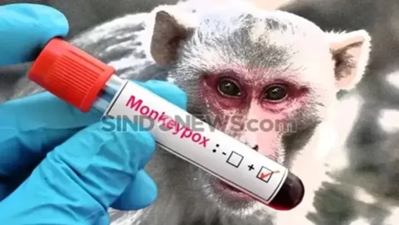 title RS Diminta Tak Tolak Pasien, Pj Gubernur Jabar Lacak Penyebaran Cacar Monyet RS Diminta Tak Tolak Pasien, Pj Gubernur Jabar Lacak Penyebaran Cacar Monyet