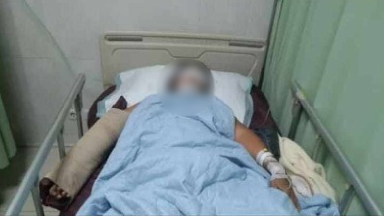 Sadis, Suami di Bangka Barat Aniaya Istri hingga Menderita Luka Serius