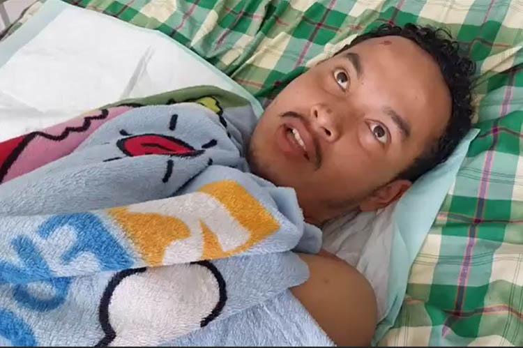 Kesaksian Arbi Muharman Korban Erupsi Gunung Marapi: Sempat Kena Hujan Batu