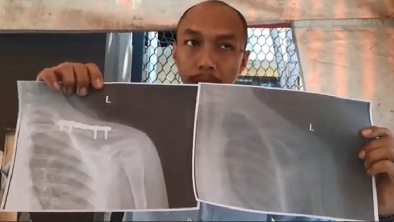 title Heboh Siswa Kelas 3 SD di Jember Diduga Di-Smackdown Teman saat Ngaji hingga Lengan Patah Heboh Siswa Kelas 3 SD di Jember Diduga Di-Smackdown Teman saat Ngaji hingga Lengan Patah