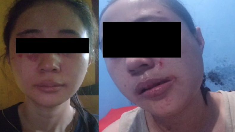 Oknum Polisi di Sukabumi Dilaporkan Istri Kasus Dugaan KDRT  