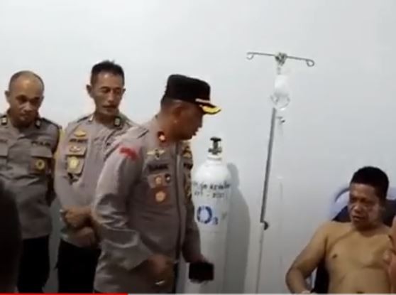 2 Anggota Polisi Terbakar saat Amankan Demo di Kantor Bupati Konawe, Begini Kondisinya