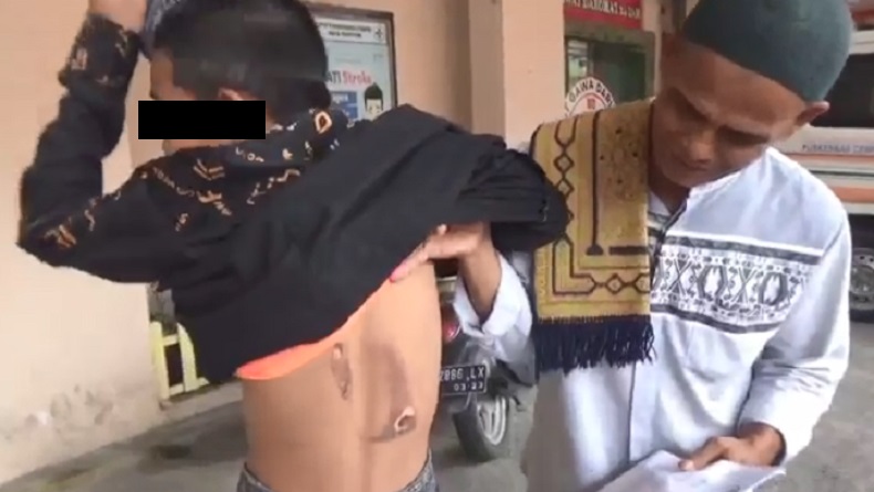 Santri di Parepare Diduga Dianiaya Guru, Badan Disetrika 