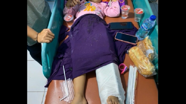 Korban Kecelakaan Minibus Angkut 15 Penumpang di Maros, Salah Satunya Balita Patah Kaki