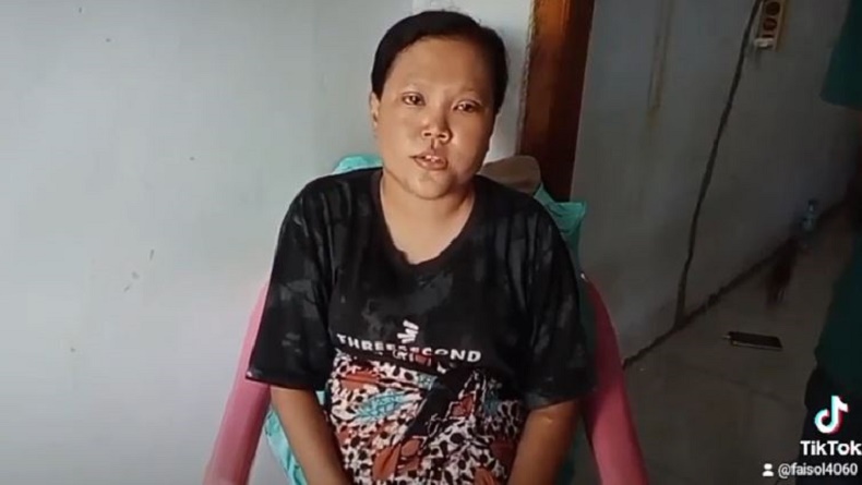 Viral Video Curhat Pilu Ibu Muda di Bangkalan, Kepala Bayinya Tertinggal di Rahim