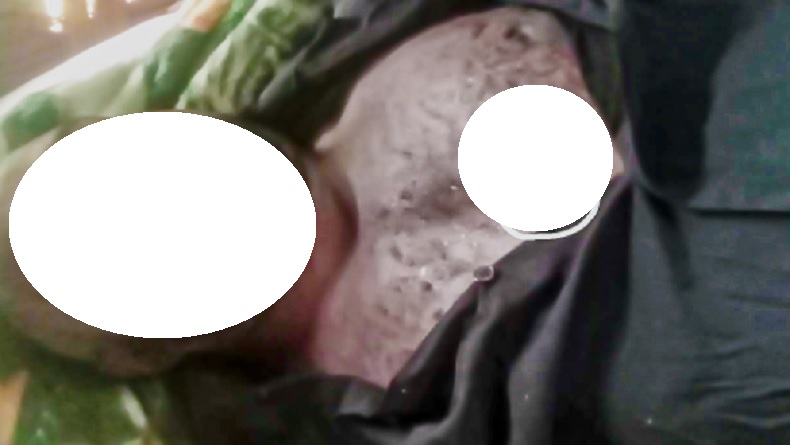 Sadis, OPM Tembak Mati Warga di Pegunungan Bintang, Tepat di Dada Tembus Belakang