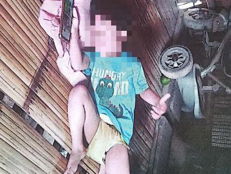 Balita di Lebak Berkelamin Ganda Butuh Uluran Tangan