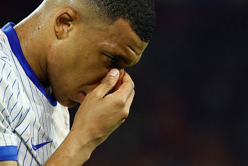 Reaksi Kylian Mbappe Cedera Hidung Berdarah hingga Kartu Kuning - Bagian 3