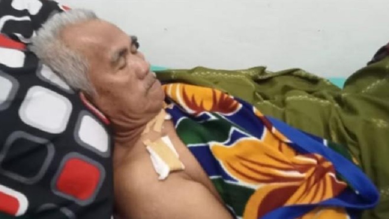 Mengerikan, Pria di Tanggamus Duel dengan Buaya hingga Luka Gigitan di Sekujur Tubuh