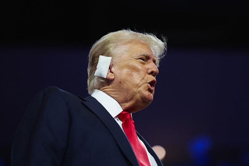 Penampakan Donald Trump Pakai Perban pada Telinga Kanan - Bagian 1