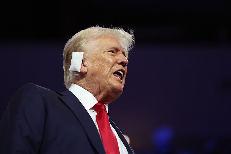 Penampakan Donald Trump Pakai Perban pada Telinga Kanan - Bagian 2