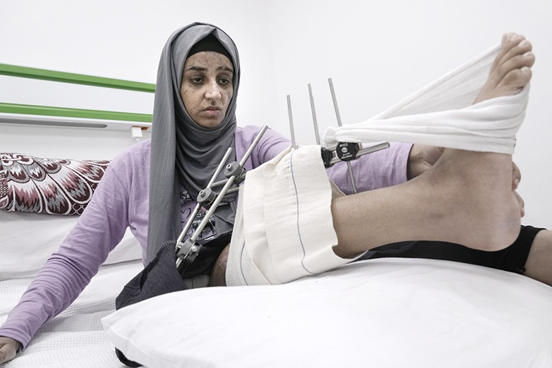 Potret Warga Palestina Terluka Parah akibat Serangan Israel Dirawat di RS Mesir - Bagian 2