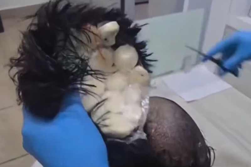 Pria Ini Pakai Rambut Palsu Berisi 19 Kapsul Kokain - Bagian 1
