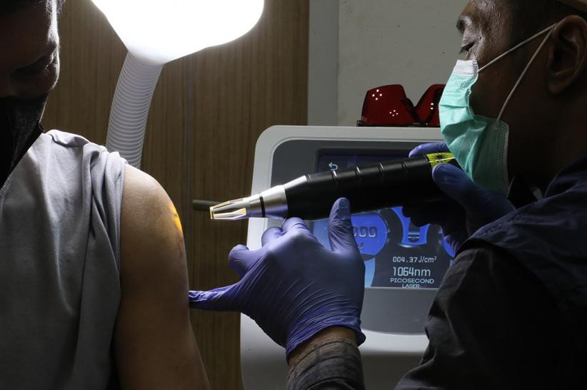 Layanan Hapus Tato Gratis di Balai Kota Jakarta, Ini Jadwalnya - Bagian 5