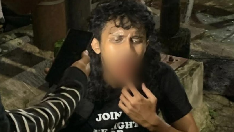title 2 Demonstran Terluka saat Bentrok dengan Aparat Masih Dirawat di RS 2 Demonstran Terluka saat Bentrok dengan Aparat Masih Dirawat di RS