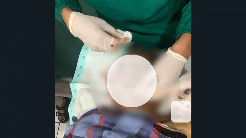 title Mantan Kapolsek Mulia Tewas Ditembak OTK, Peluru Tembus Pipi hingga Leher Belakang Mantan Kapolsek Mulia Tewas Ditembak OTK, Peluru Tembus Pipi hingga Leher Belakang