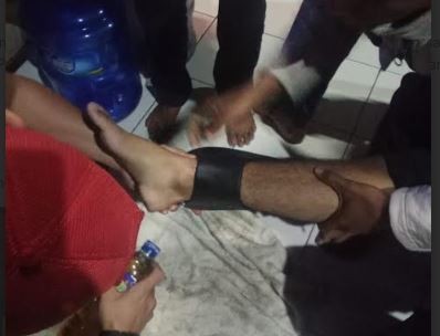 Sandal Baru Nyangkut di Betis, Remaja di Cicalengka Datangi Damkar