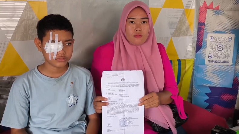 title Tragis, Siswa SMP di Gowa Buta akibat Terkena Panah dari Tusuk Bakso oleh Temannya Tragis, Siswa SMP di Gowa Buta akibat Terkena Panah dari Tusuk Bakso oleh Temannya