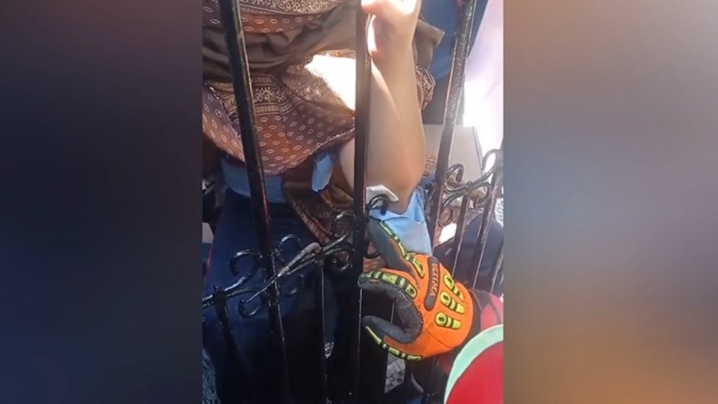 Tragis! Siku Tangan Bocah SD Tertusuk Pagar Besi Sekolah di Makassar