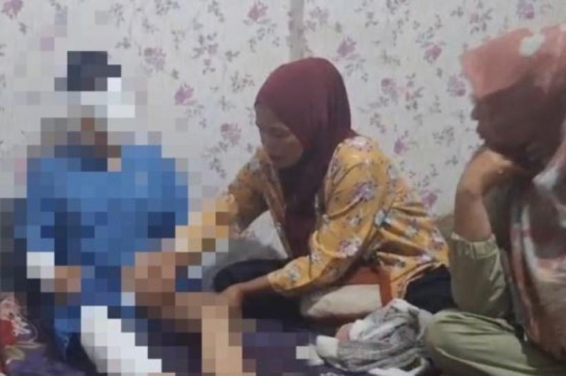Perempuan Muda di Balikpapan Luka Bakar, Diduga Disiram Orang Tua Angkat Pakai Air Panas