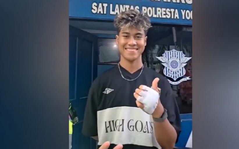 Viral Pembalap Muda Nasional Aldi Satya jadi Korban Tabrak Lari di Jogja