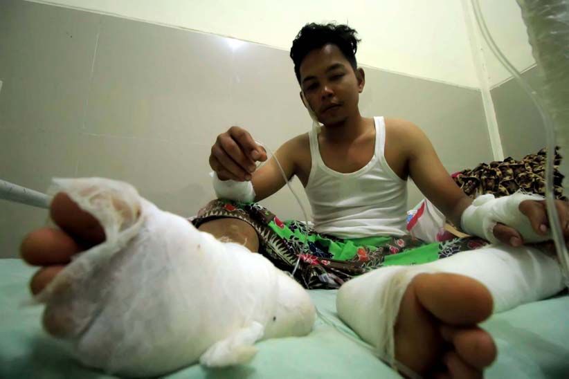 Begini Kondisi Korban Luka Bakar akibat Ledakan Sumur Minyak di Aceh Timur - Bagian 2