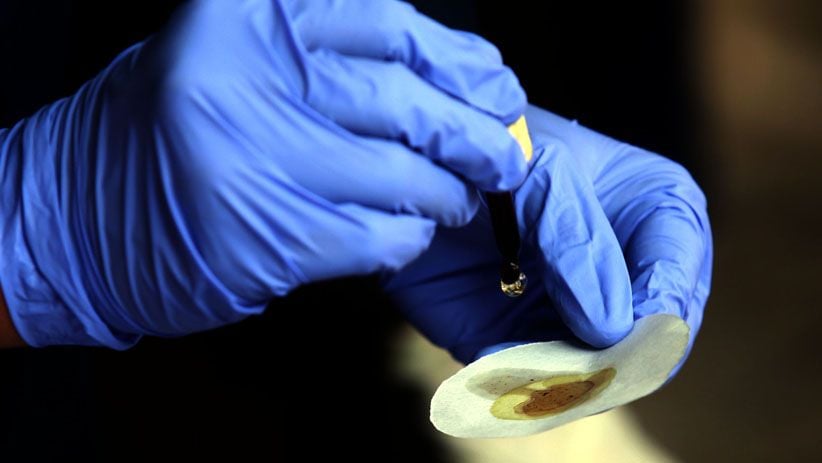 Terjaring Razia, Perempuan Cantik Ini Positif Amphetamine Hasil Tes Urine