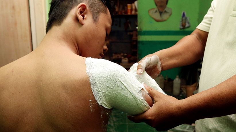 Melihat Proses Pembuatan Kaki dan Tangan Palsu - Bagian 4