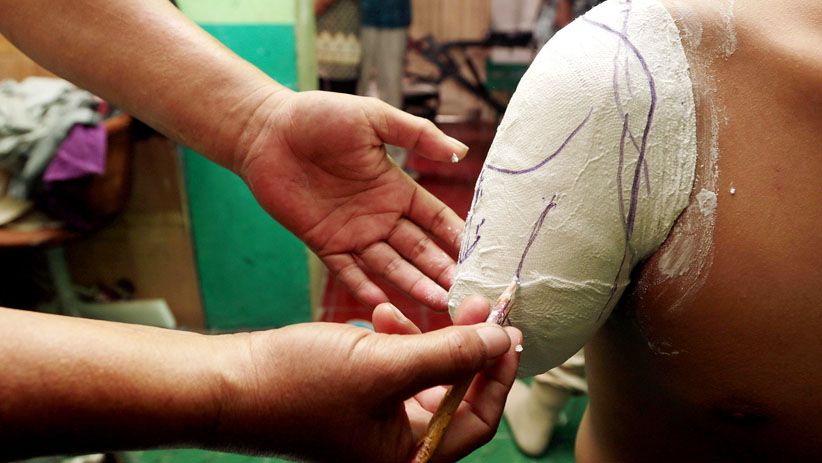 Melihat Proses Pembuatan Kaki dan Tangan Palsu - Bagian 3