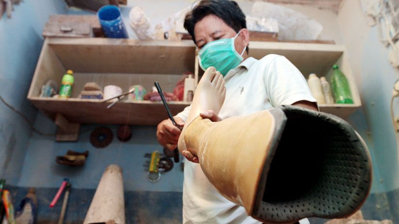 Melihat Proses Pembuatan Kaki dan Tangan Palsu - Bagian 9