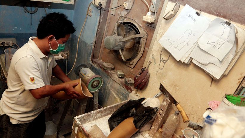 Melihat Proses Pembuatan Kaki dan Tangan Palsu - Bagian 8