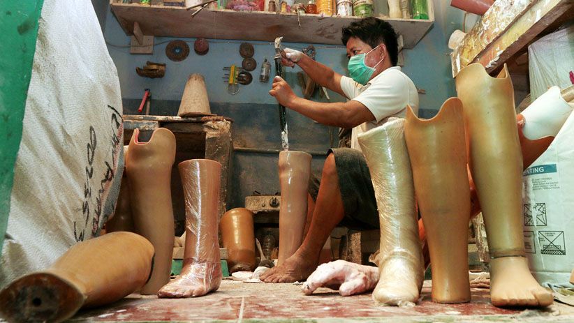 Melihat Proses Pembuatan Kaki dan Tangan Palsu - Bagian 2