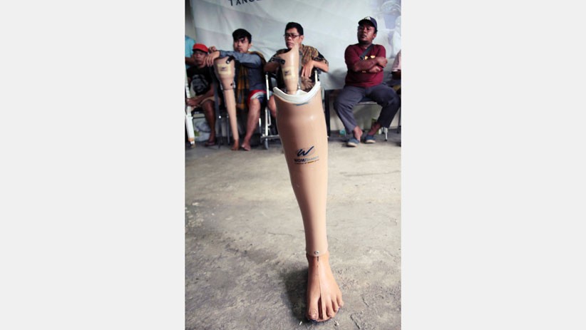 150 Orang Terima Bantuan Kaki dan Tangan Palsu dari WOM Finance - Bagian 3