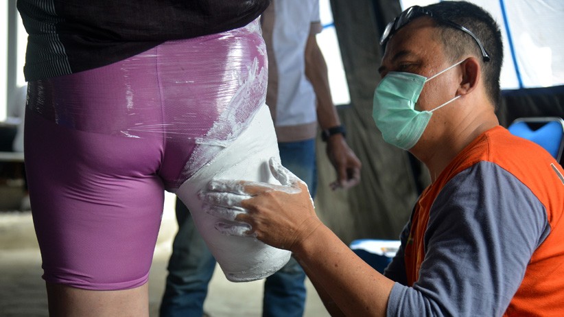 Pemerintah Aceh Salurkan 100 Kaki Palsu untuk Penyandang Disabilitas