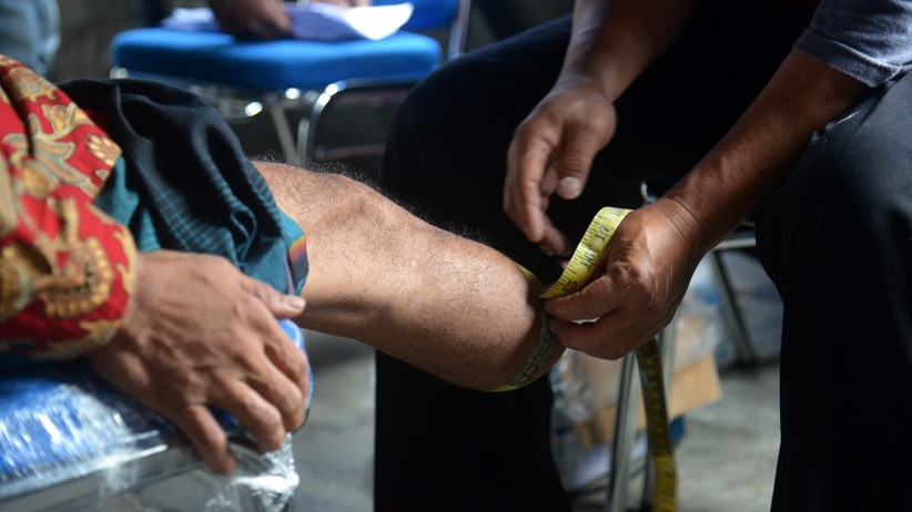 Pemerintah Aceh Salurkan 100 Kaki Palsu untuk Penyandang Disabilitas - Bagian 2